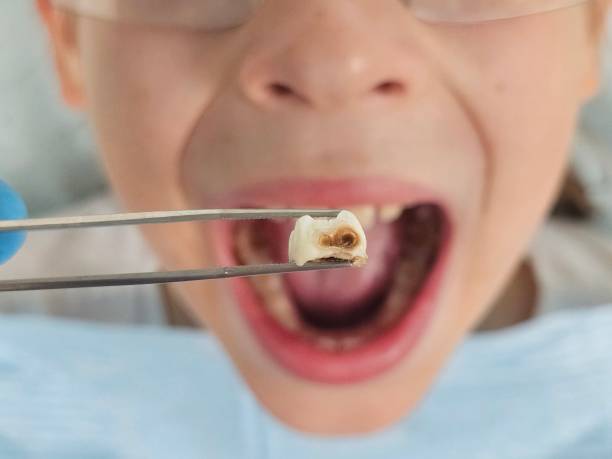 Best Pediatric Emergency Dentist in Covelo, CA